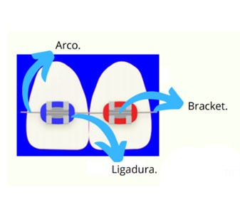 Paleta de Colores de brackets