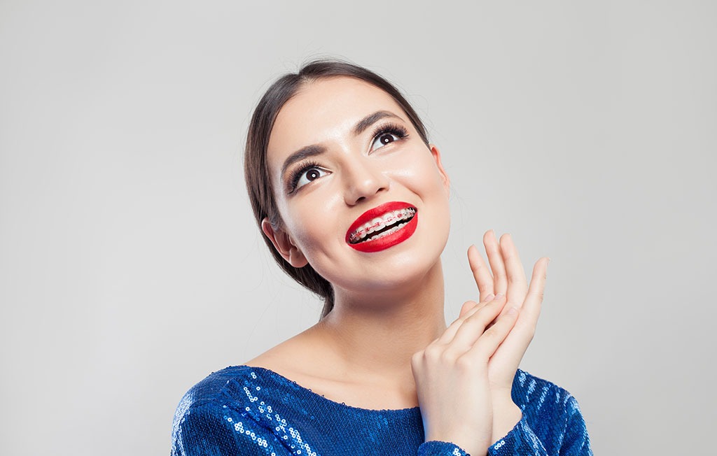 Brackets de acuerdo al maquillaje